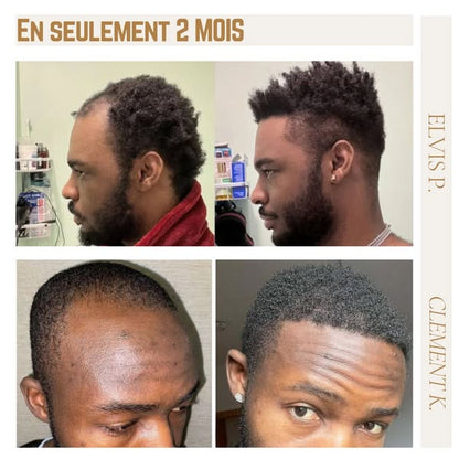 Silken®| Huile de Croissance des Cheveux  (1 Boîte = 1 Mois d'utilisation)