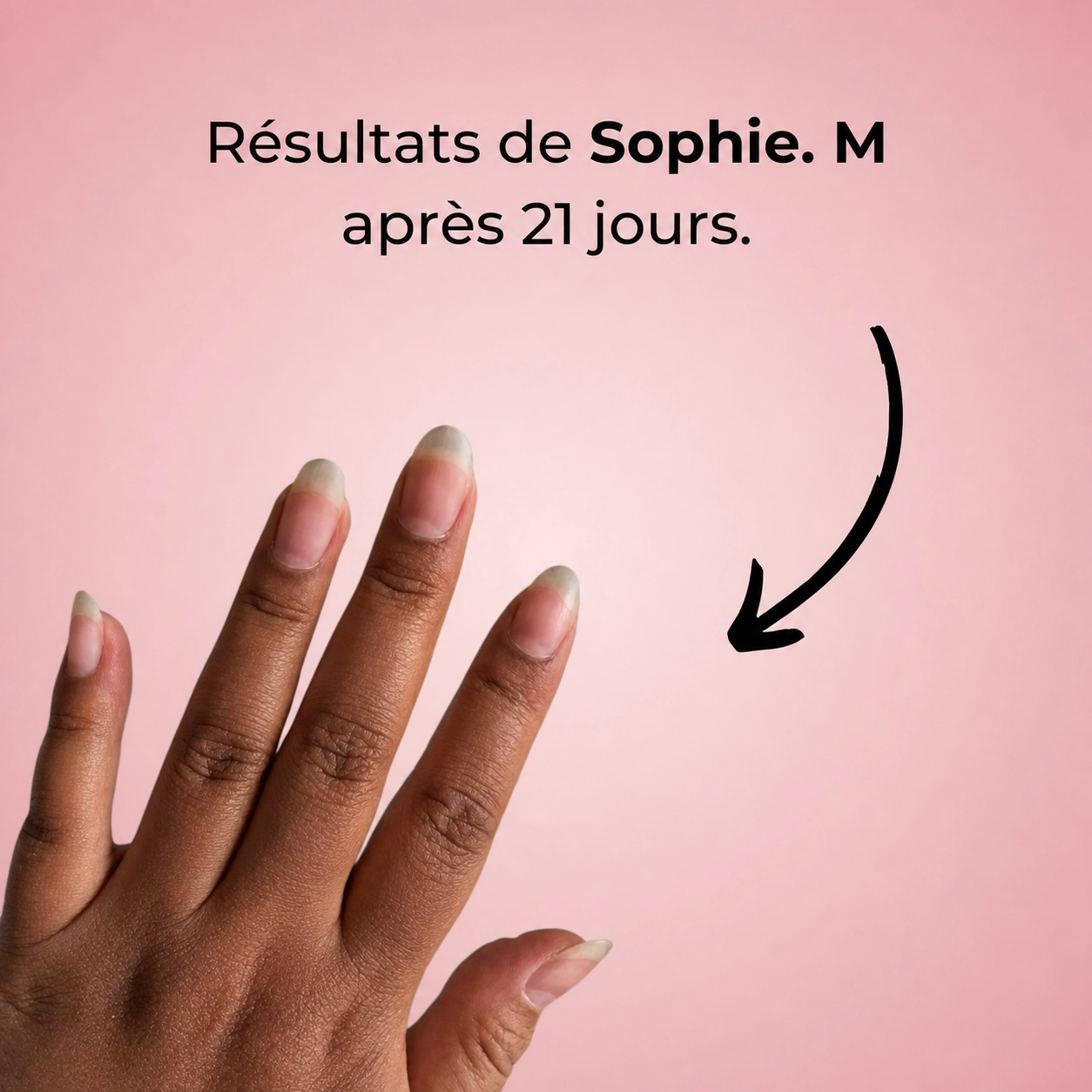 Sérum de Croissance des Ongles