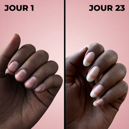 Sérum de Croissance des Ongles